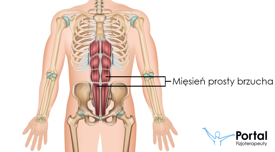 Mięsień prosty brzucha