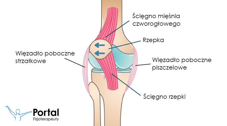 Lateralizacja rzepki (boczne przyparcie rzepki)
