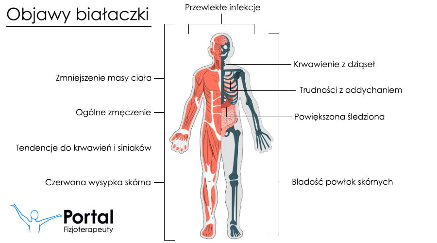 Białaczka - objawy