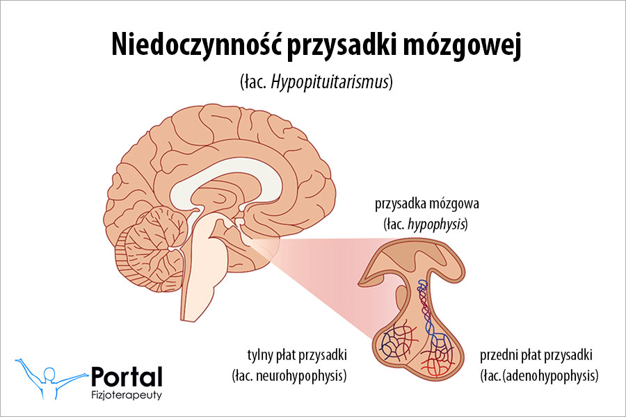 Niedoczynność przysadki