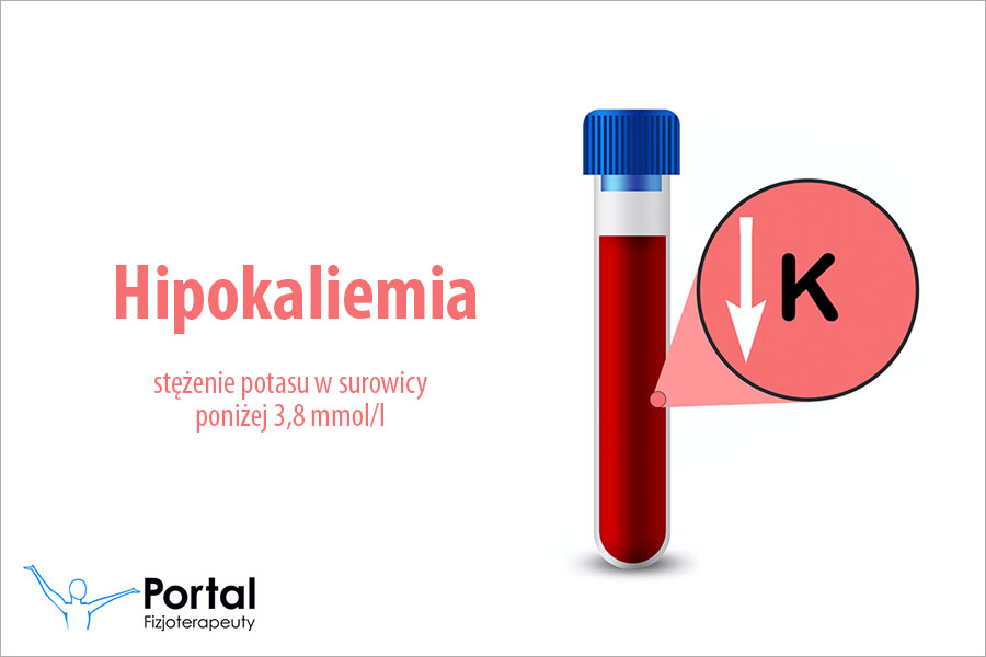Hipokaliemia
