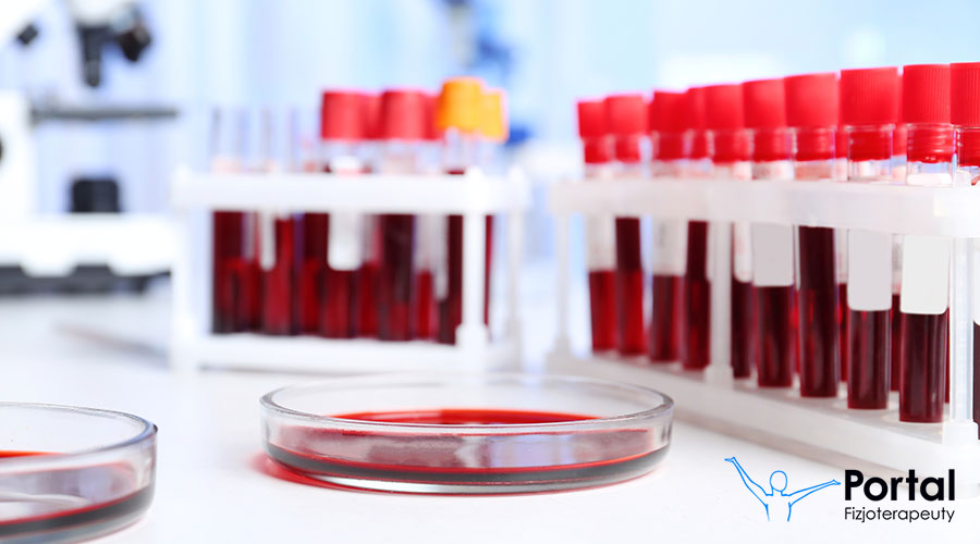 Niedokrwistość Fanconiego