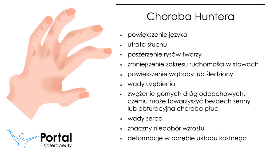 Choroba Huntera