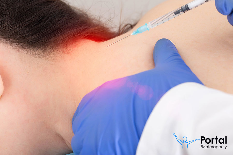 Blokada nerwów potylicznych