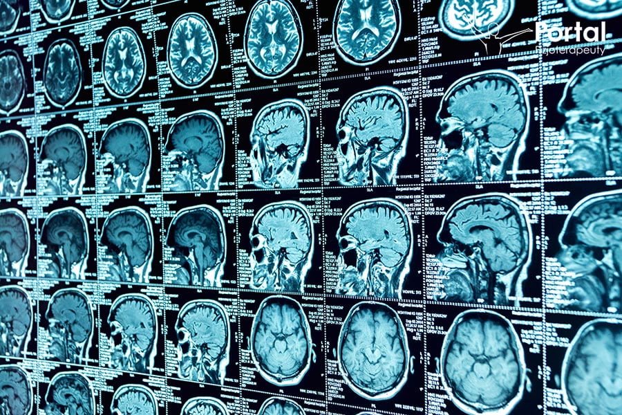 Rodzaje kontrastów w rezonansie