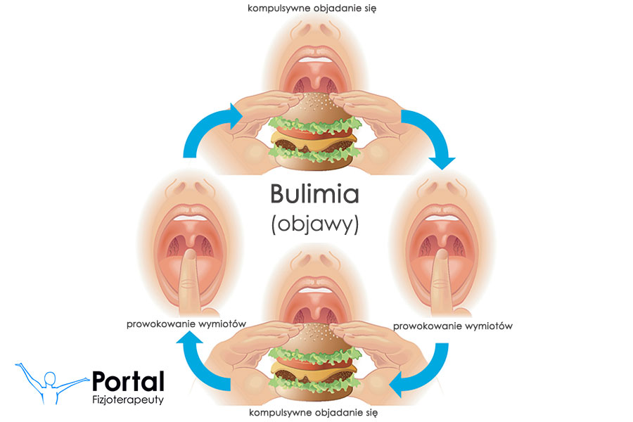 Bulimia