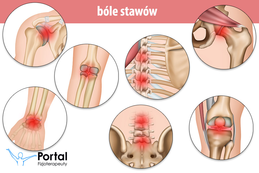 Bóle stawów