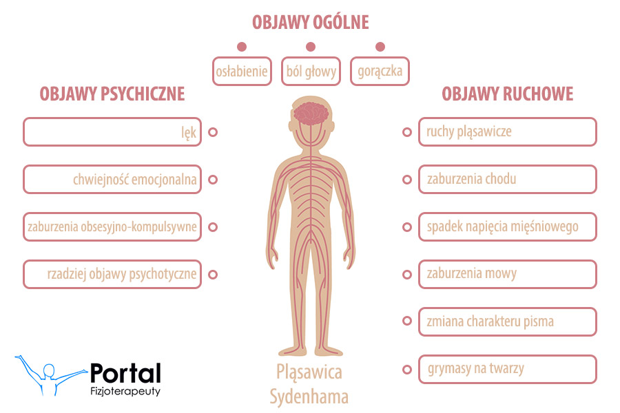 Pląsawica Sydenhama