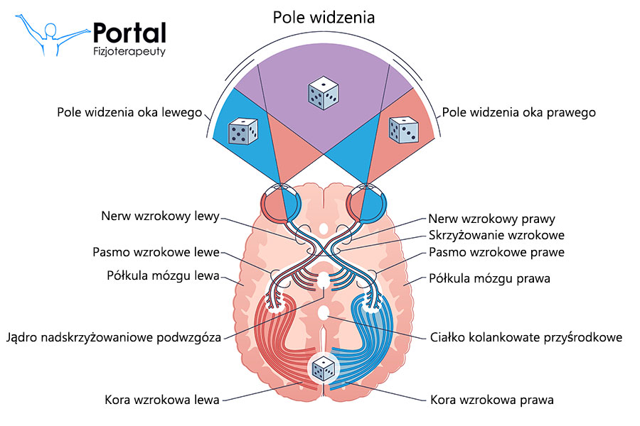 Niedowidzenie połowicze