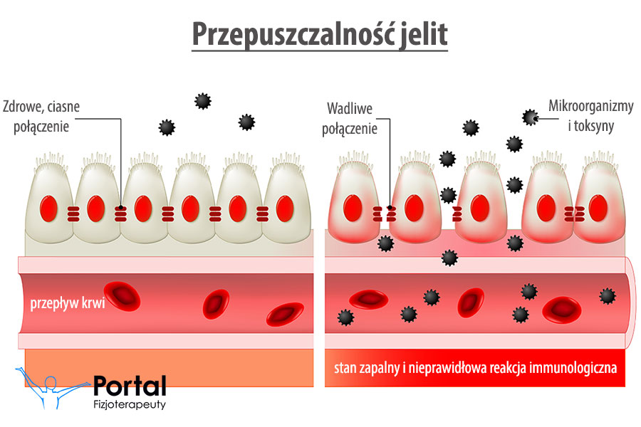 Zonulina - przepuszczalność jelita