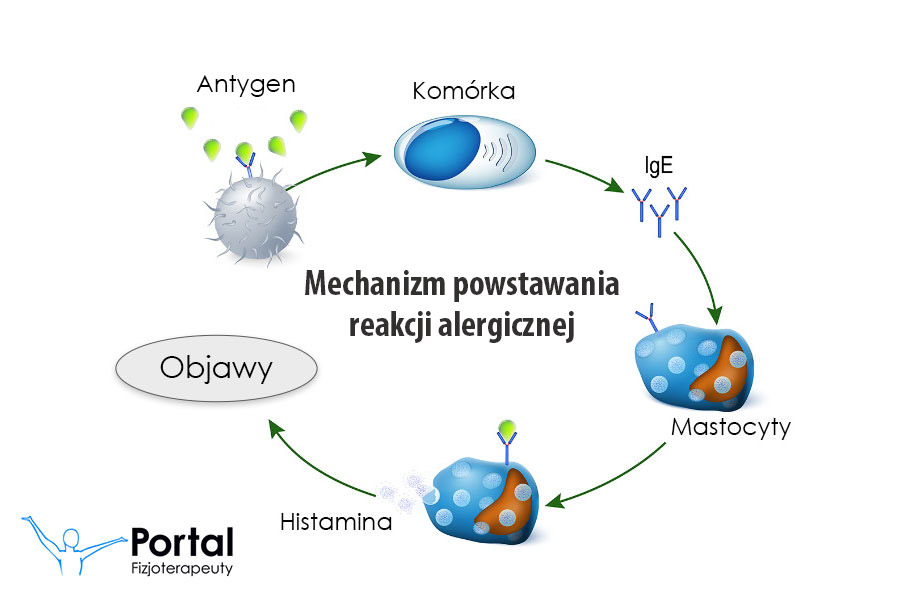 Alergia - mechanizm powstawania reakcji alergicznej
