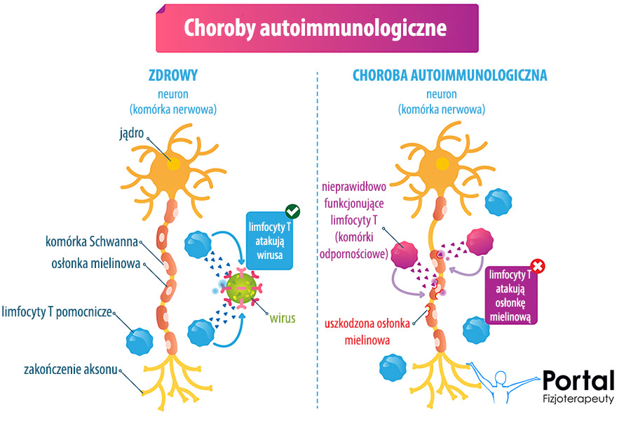 Choroby autoimmunologiczne