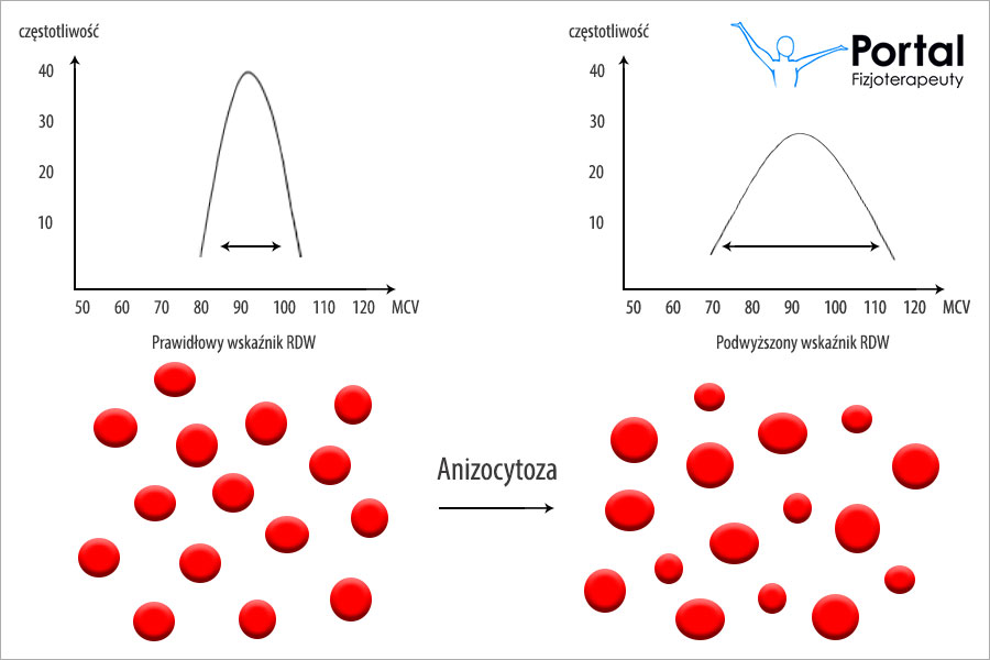 RDW (ang. Red Blood Cell Volume Distribution Width)