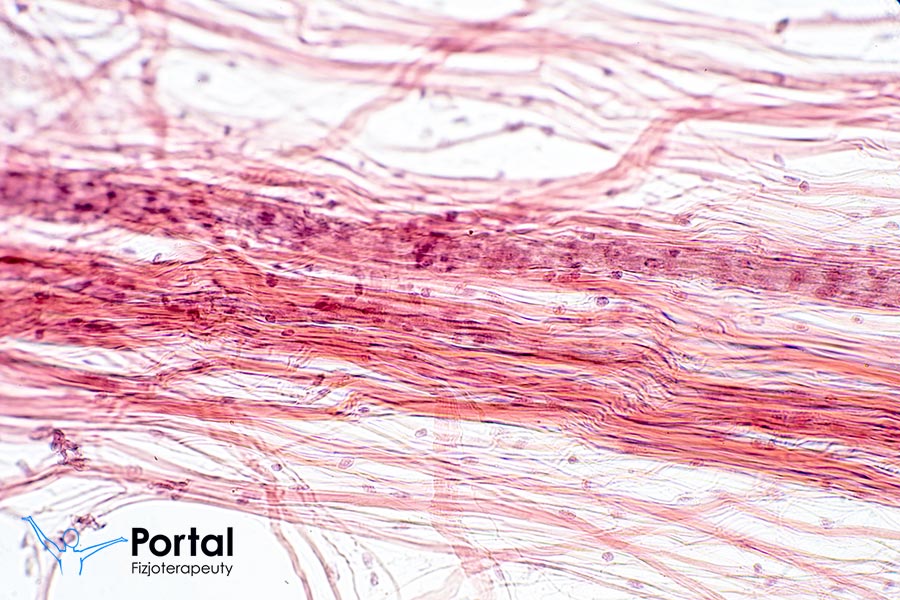 Tkanka łączna włóknista zbita