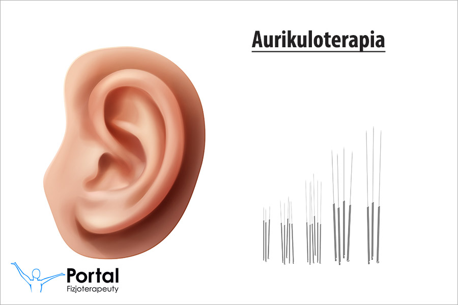Aurikuloterapia