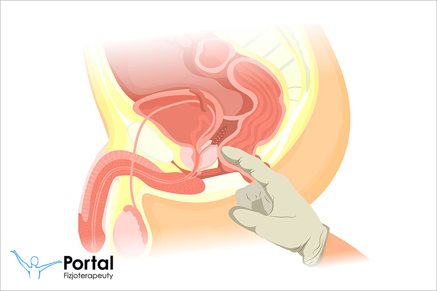 Badanie per rectum