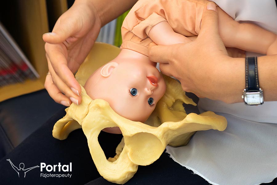 Urazy okołoporodowe