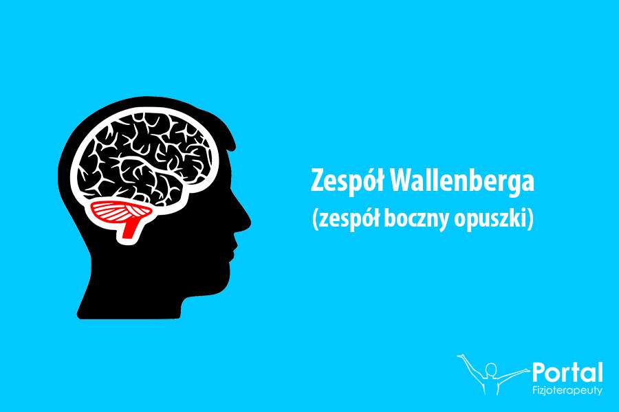 Zespół Wallenberga (zespół boczny opuszki)