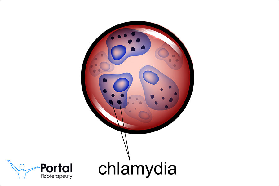 Chlamydia