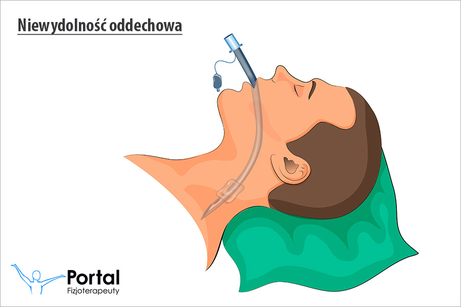 Niewydolność oddechowa