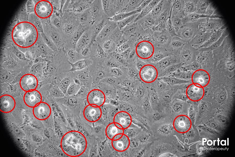 Immunoterapia