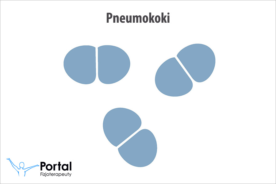 Dwoinka zapalenia płuc