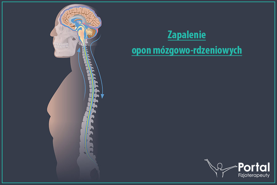 Zapalenie opon mózgowo-rdzeniowych