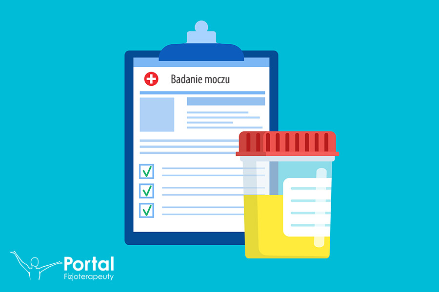Badanie moczu