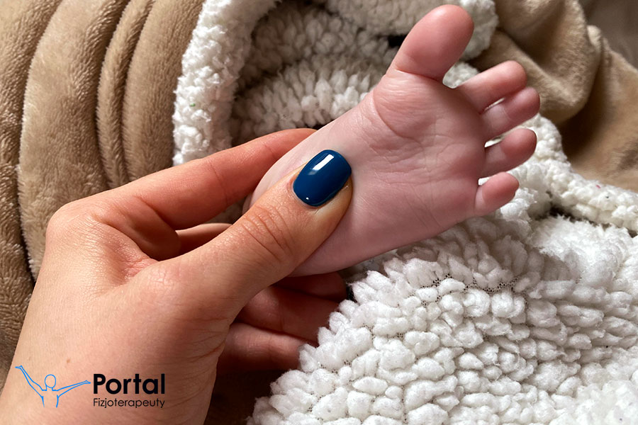 Akupresura niemowląt