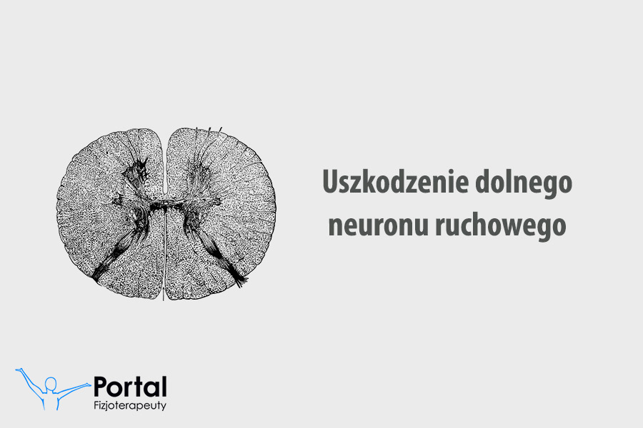 Uszkodzenie dolnego neuronu ruchowego