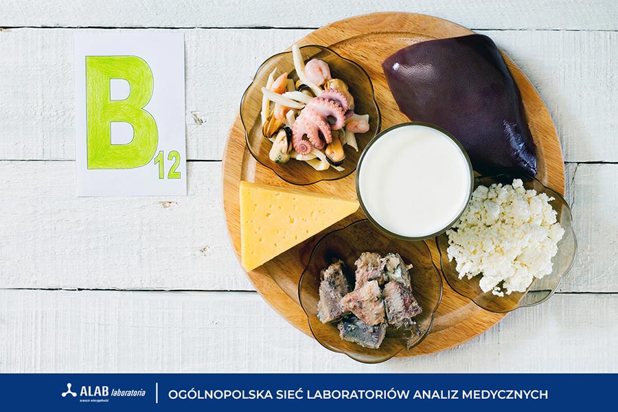 Witamina B12 – dlaczego jest tak istotna i jak ją suplementować?