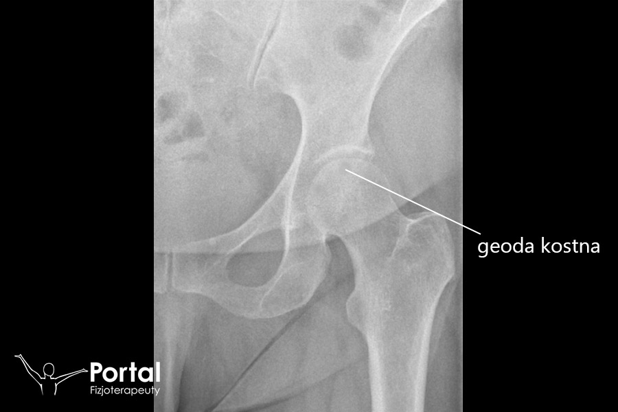 Geoda kostna
