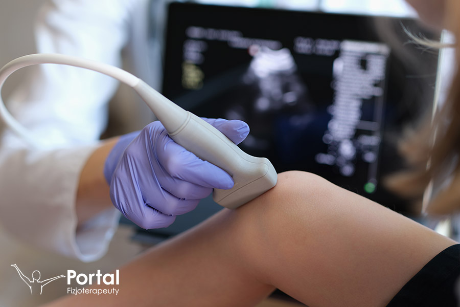 Młodzieńcze idiopatyczne zapalenie stawów