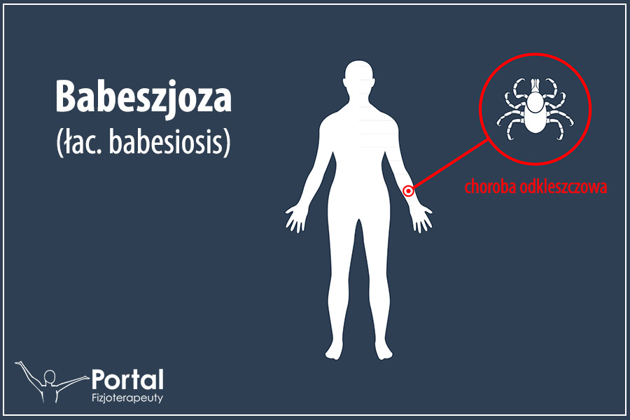 Babeszjoza (łac. babesiosis)