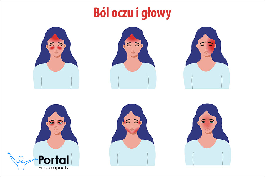 Ból oczu i głowy