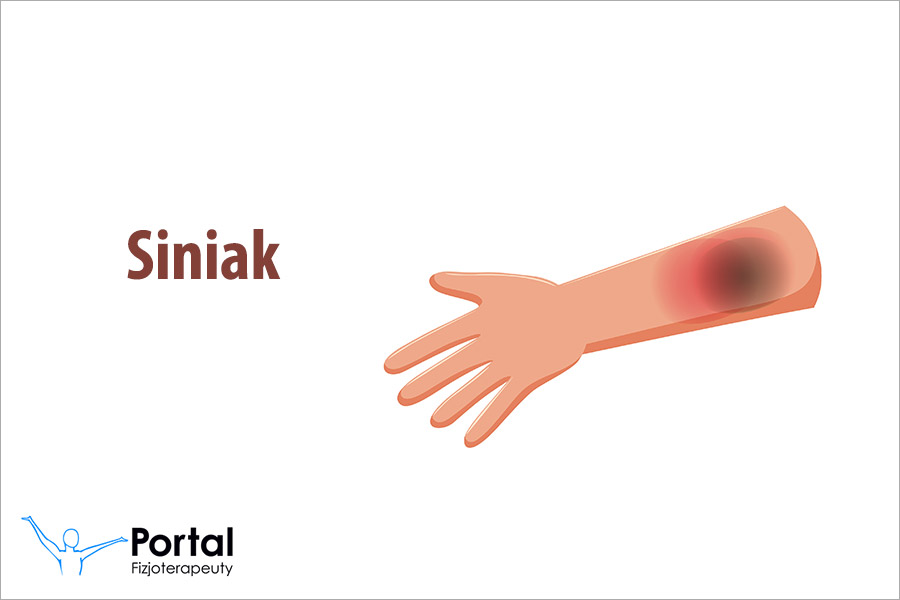 Siniak