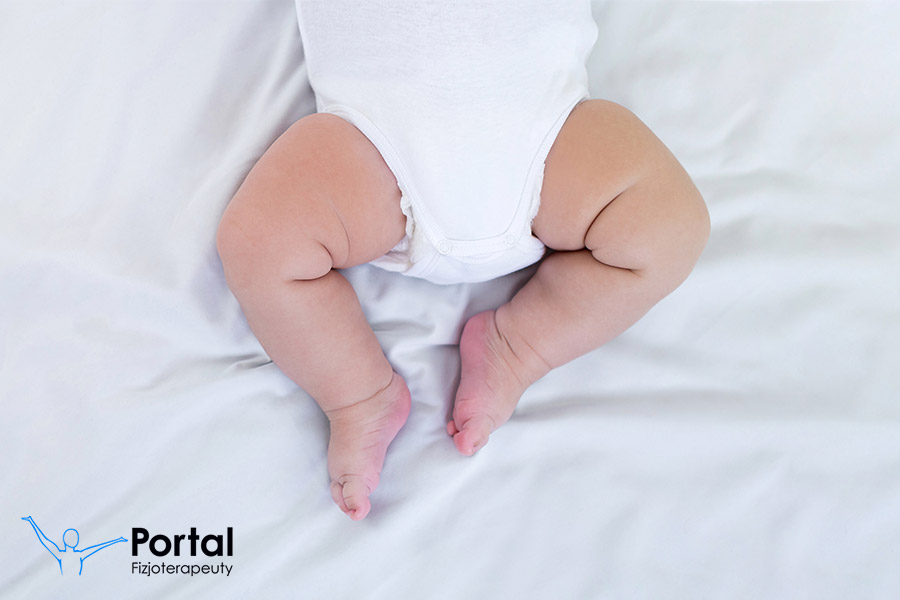 Co na odparzenia u niemowląt?