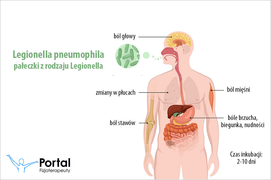 Legionella pneumophila