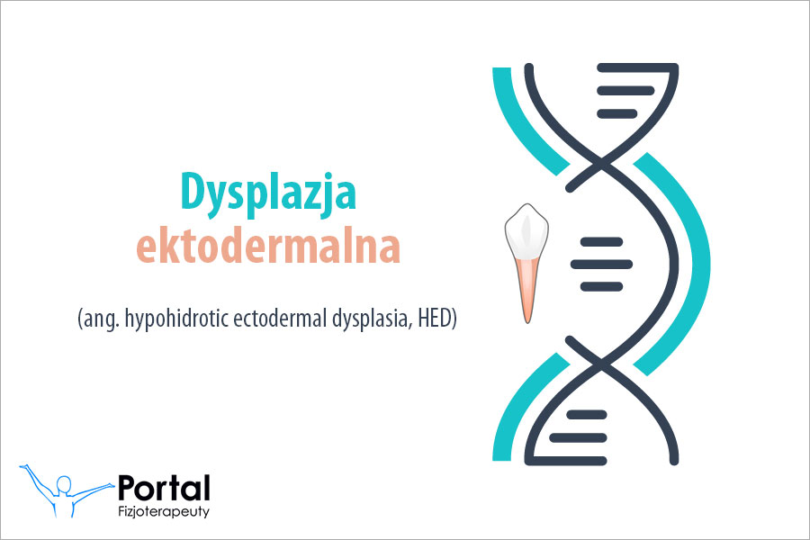 Dysplazja ektodermalna