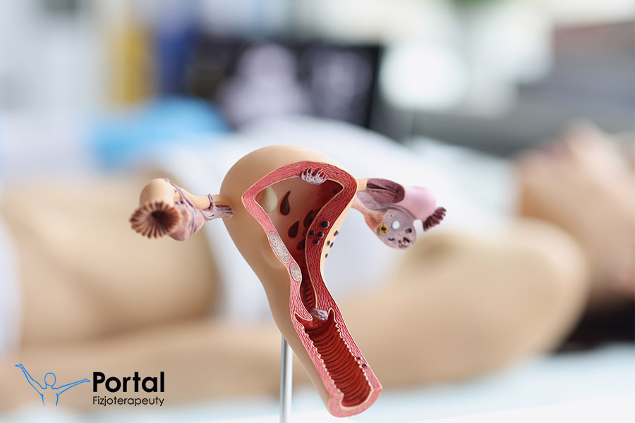 Kurs fizjoterapii uroginekologicznej