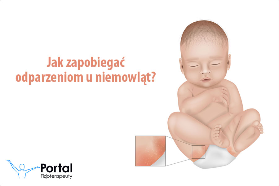 Jak zapobiegać odparzeniom u niemowląt?