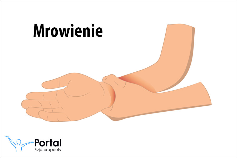 Mrowienie