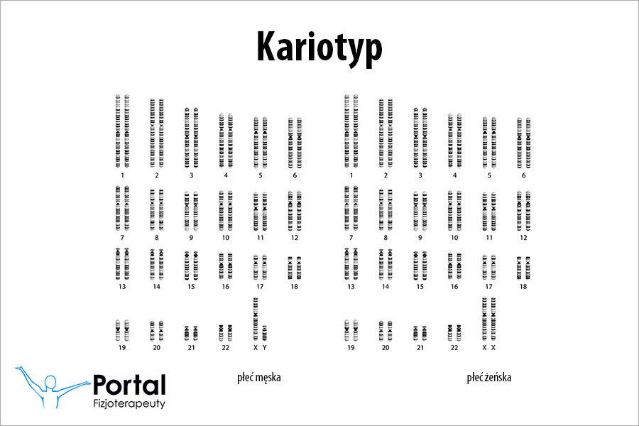 Kariotyp