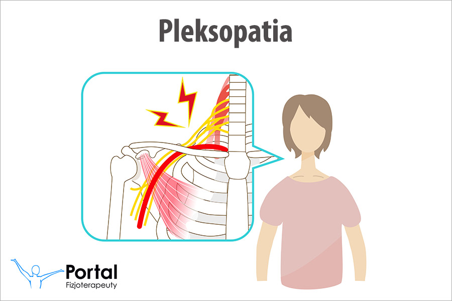 Pleksopatia