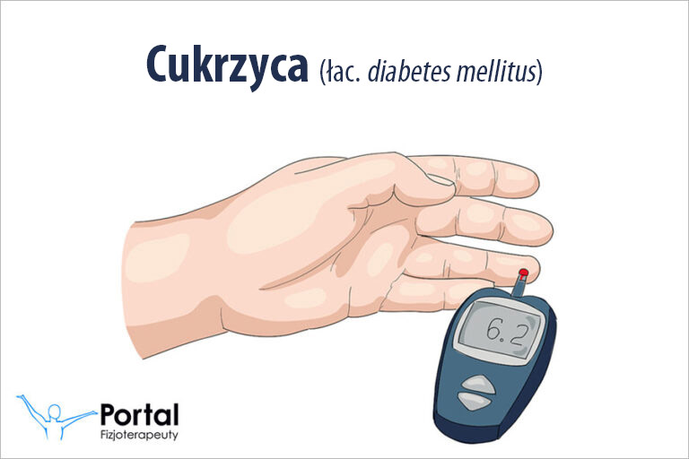 Cukrzyca