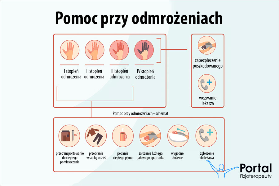 Pomoc przy odmrożeniach