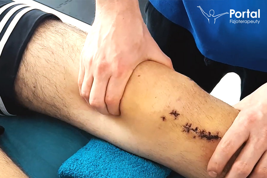 Urazy kolana na nartach