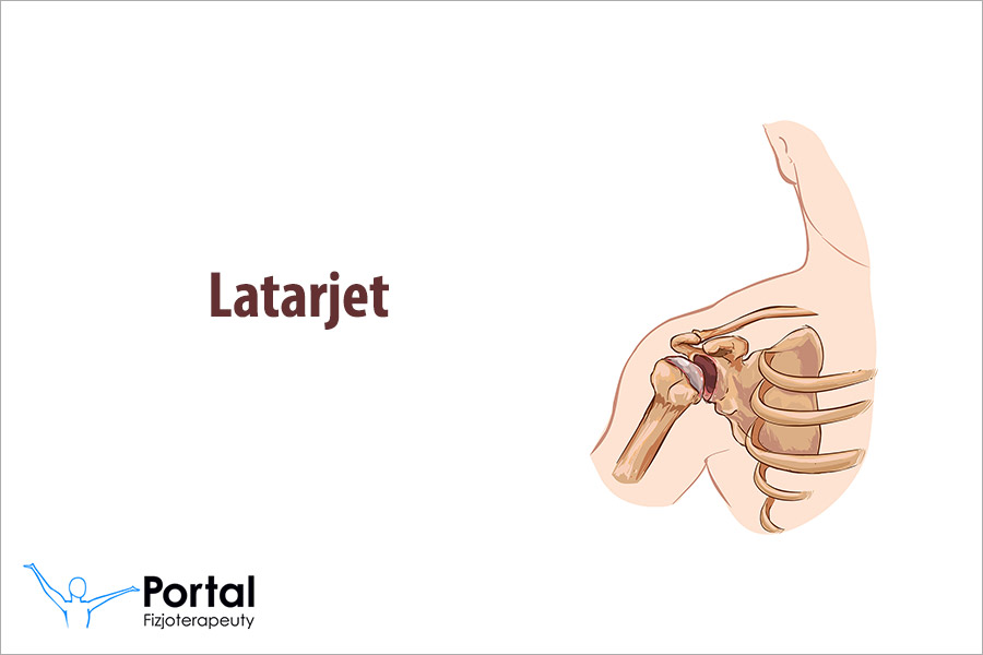Latarjet