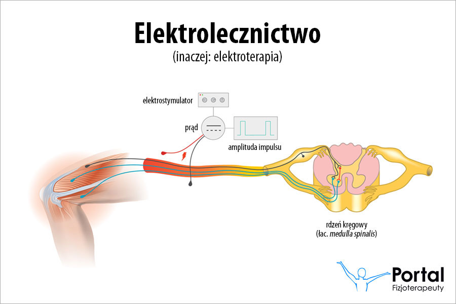 Elektrolecznictwo
