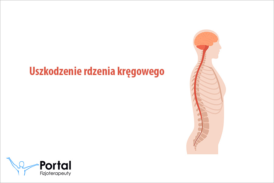 Uszkodzenie rdzenia kręgowego